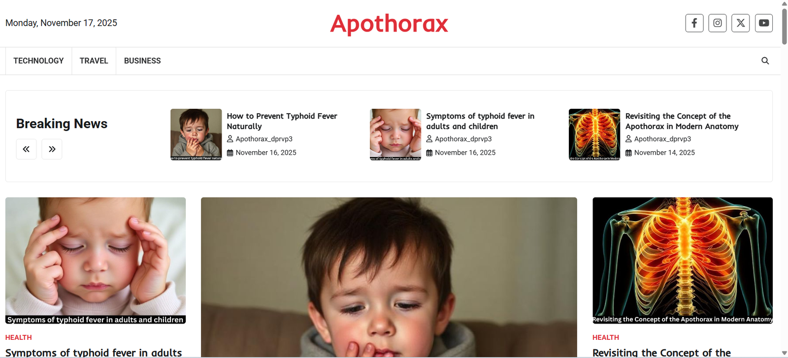Common Questions About the Apothorax – A Student’s Guide